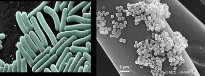 Electron micrograph of rod-shaped and spherical bacteria