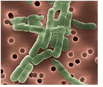 Membrane filtration method for viable cell count