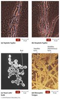 Fungal morphology: hyphae and yeast