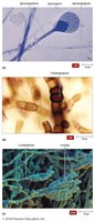 Asexual spores of molds