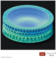 Diatom Paralia sulcata