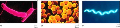 Various shapes of bacteria: bacillus, coccus, and spiral