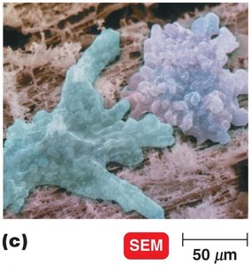 Protozoa with pseudopods