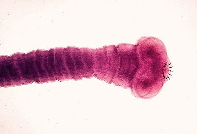 Tapeworm (helminth)