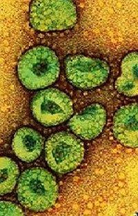Electron micrograph of viruses