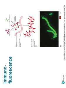 Sample results of a GFP stain