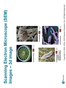 Comparison of bright-field and dark-field microscopes