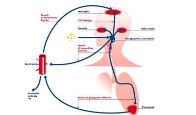 Diagram of S. pneumoniae infection outcomes