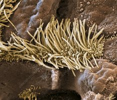 Motile cilia on a cell surface