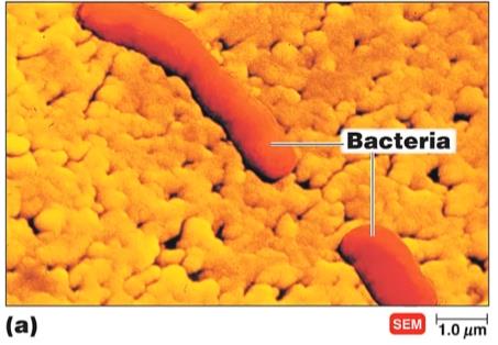 Scanning electron micrograph of rod-shaped bacteria