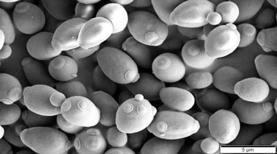 Scanning electron micrograph of yeast cells