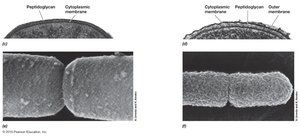 Electron micrographs of Gram-positive and Gram-negative cell walls
