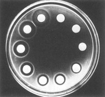 Chemotaxis: response to chemical gradients
