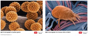 Localized anaphylaxis: micrographs of pollen grains and house mite