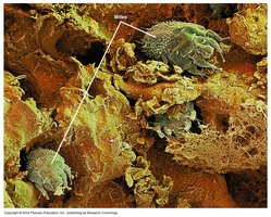 Microscopic image of Sarcoptes scabiei mite burrowing in skin