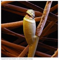 Louse egg (nit) attached to a hair shaft