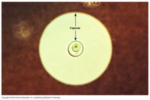 India ink preparation showing capsule of Cryptococcus neoformans