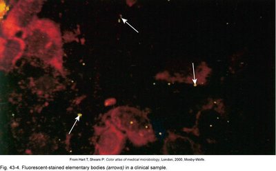Fluorescent-stained elementary bodies in clinical sample