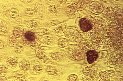 Giemsa-stained inclusion bodies in Chlamydia-infected cells