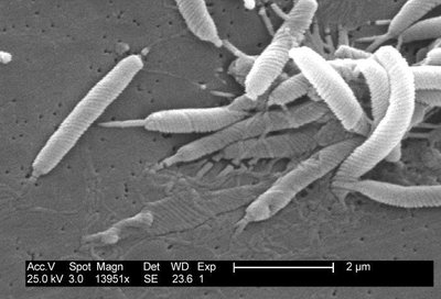 Electron micrograph of Helicobacter pylori