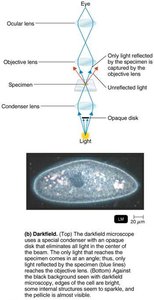 Darkfield microscopy: light path and specimen image