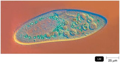 DIC microscopy image
