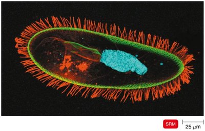 Super-resolution microscopy image