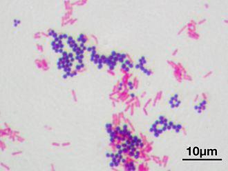 Gram-positive and gram-negative cell wall structure