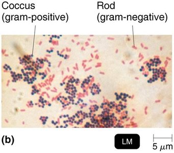 Gram stain results: coccus (gram-positive) and rod (gram-negative)
