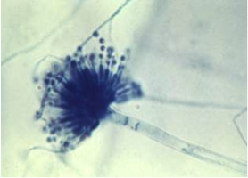 Microscopic image of Aspergillus