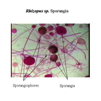 Rhizopus sp. sporangia