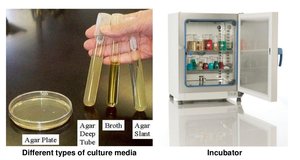 Different types of culture media and incubator