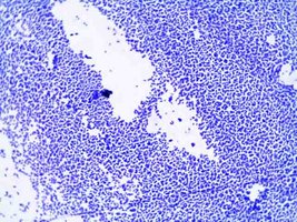 Simple stain with methylene blue
