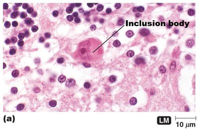 Inclusion body in viral-infected cell