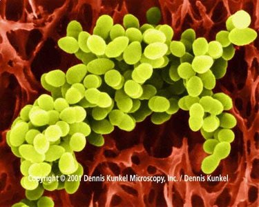 Staphylococcus aureus bacteria