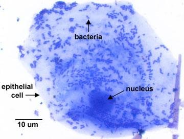 Bacteria on a human epithelial cell