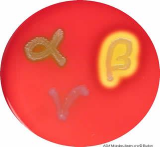 Hemolysis patterns on blood agar