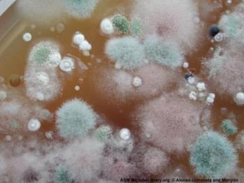 Sabouraud dextrose agar with fungal growth
