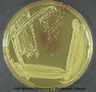 MacConkey agar with lactose fermenters and non-fermenters