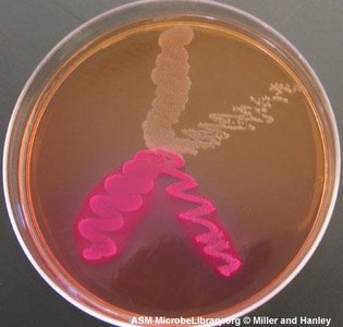 Mannitol salt agar with fermenters and non-fermenters