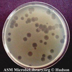 Cell culture after viral infection showing CPE