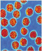 Electron micrograph of viruses