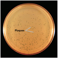 Bacteriophage plaques on a bacterial lawn