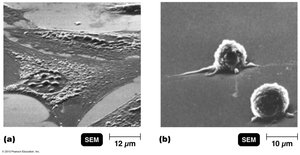 Cytopathic effect of viruses on cell cultures
