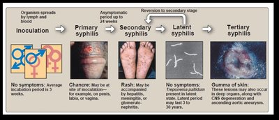 Chancre in male (primary syphilis)