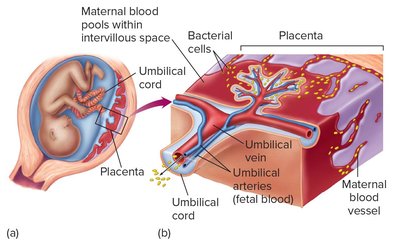 Diagram of transplacental infection