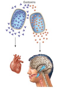 Diagram of exotoxin effects on heart and brain