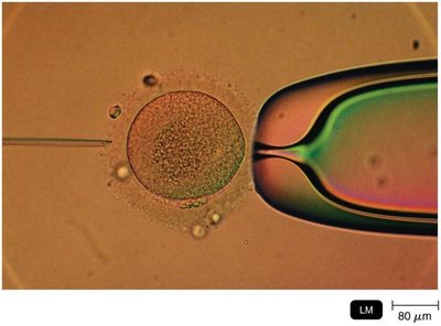 Microinjection of DNA