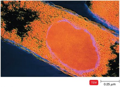 Genetically modified E. coli producing human protein