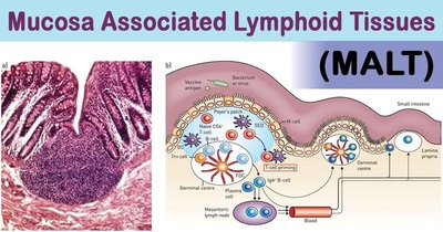 Mucosa-associated lymphoid tissue (MALT)